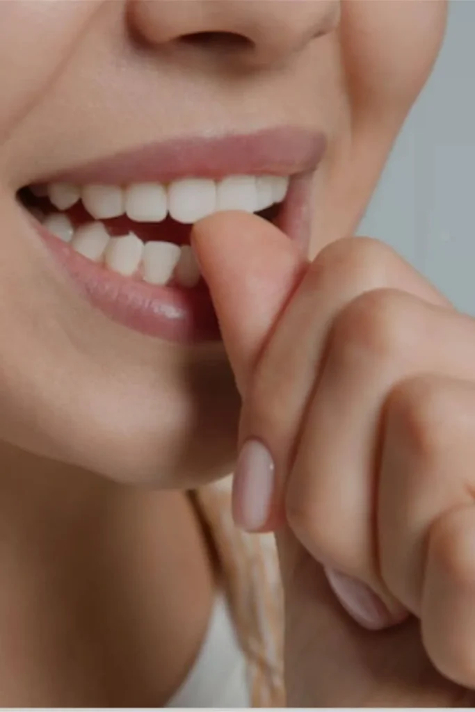 Close-up of a woman biting her nail to illustrate habits that prevent you from learning how to grow nails fast.